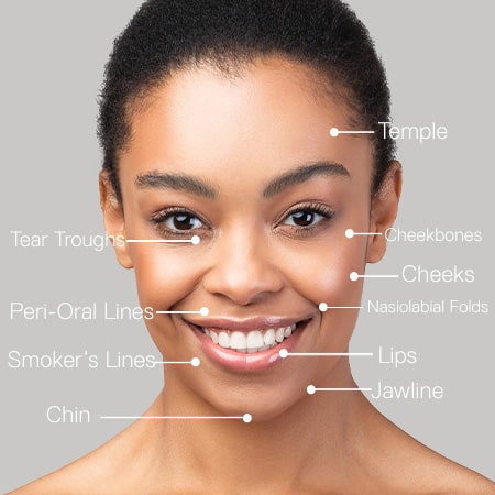 What is Dermal Filler, and does it really enhance beauty